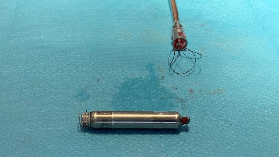 Nano-kardiostimulátor nové generace je menší než slabší tužková baterie