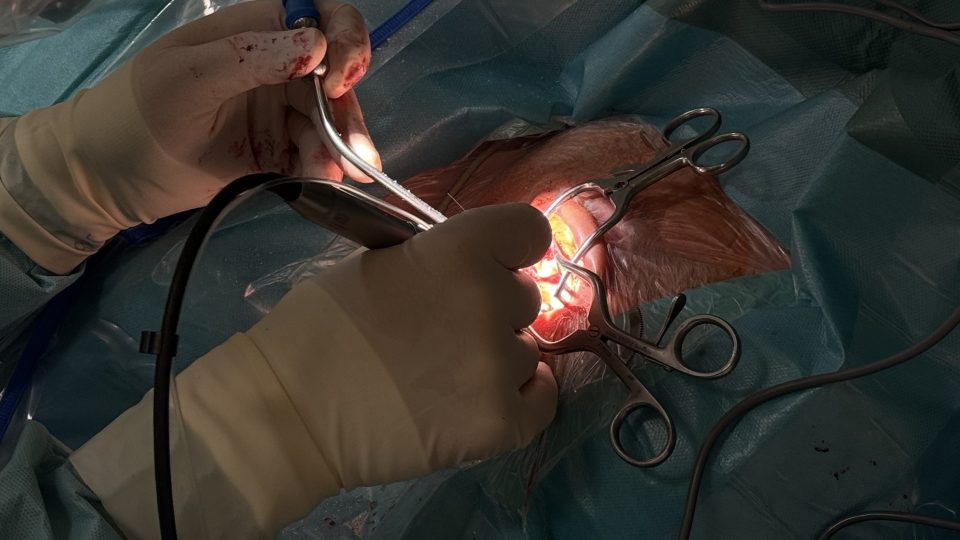 Zavádění kochleárního implantátu pouze v lokální anestezii provádějí v Motole jako první v Česku a jedni z prvních v Evropě