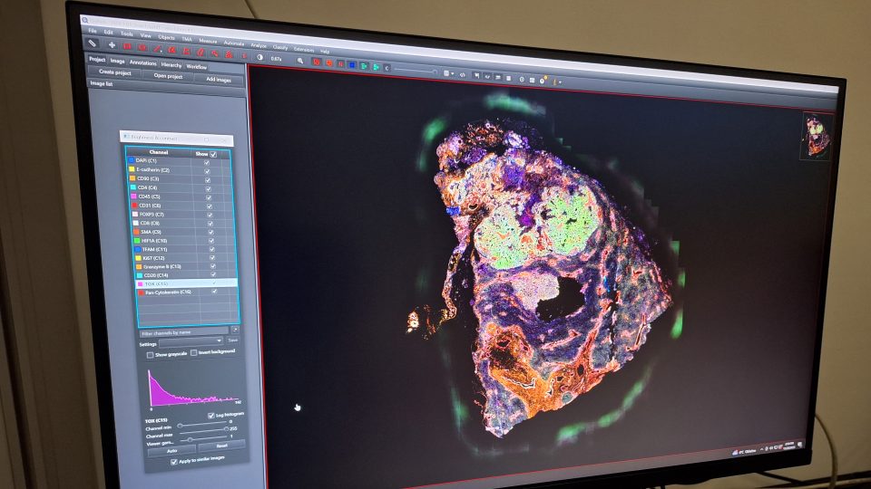 Fenocyklér umožňuje identifikovat až 100 klíčových markerů na vzorcích jaterní tkáně | foto: Andrea Skalická, Český rozhlas Fenocyklér umožňuje identifikovat až 100 klíčových markerů na vzorcích jaterní tkáně