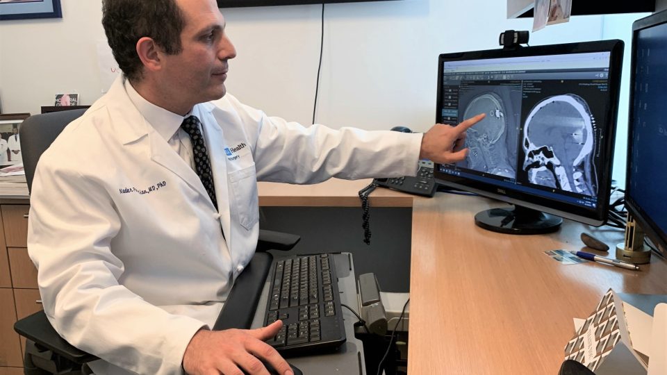 Doktor Nader Pouratian z Kalifornské univerzity ukazuje kortikální implantát v mozku pacienta