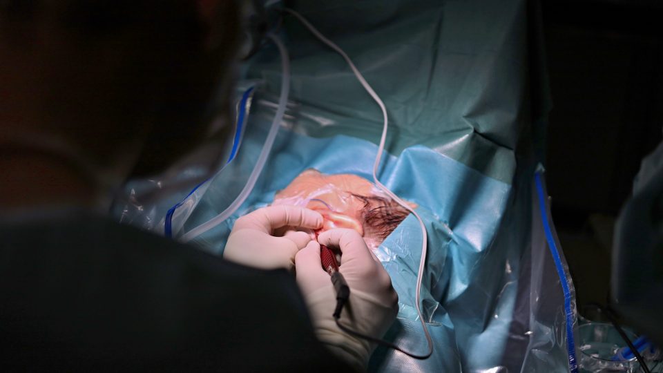 Chirurg bere do rukou skalpel a laser