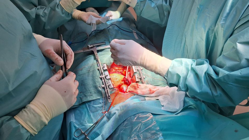 Síťka se před implantací musí rozstřihnout nůžkami | foto: Andrea Skalická, Český rozhlas Síťka se před implantací musí rozstřihnout nůžkami