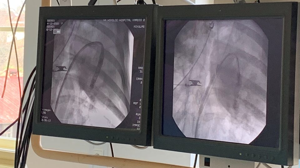 Průběh operace sledují lékaři na rentgenu a také pomocí EKG