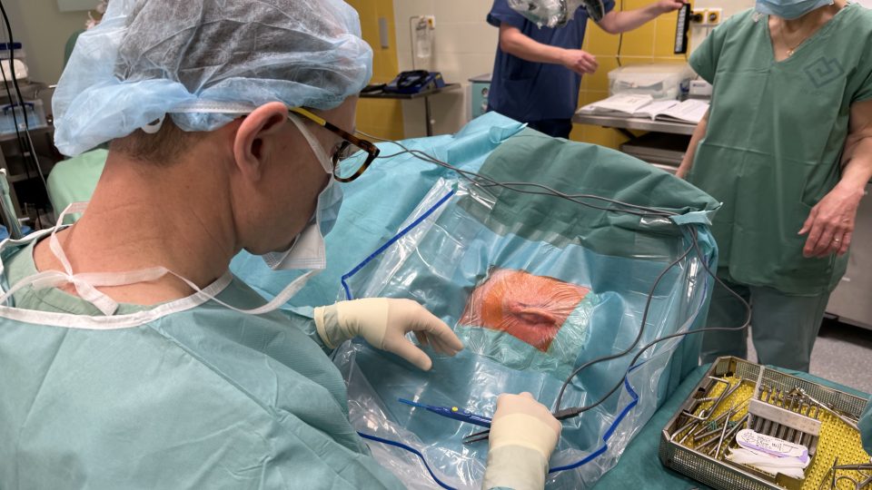 Lékaři ve Fakultní nemocnici v Motole vylepšili operace zavádějící kochleární implantát
