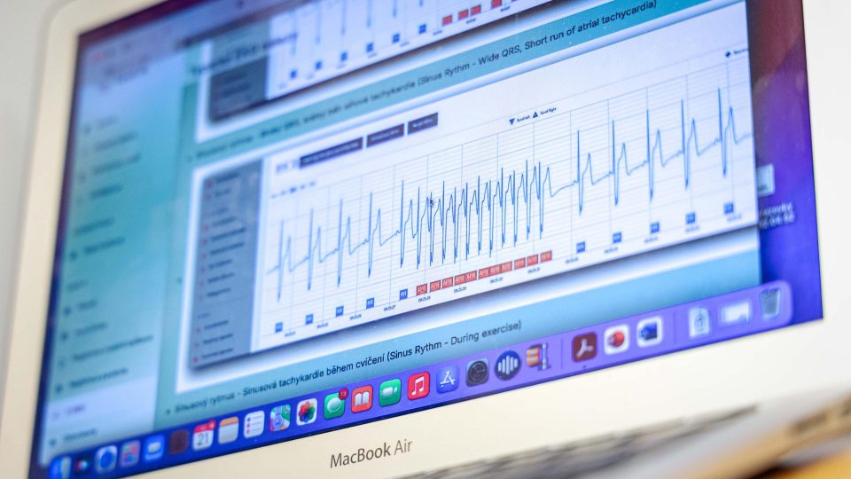 Umělá inteligence umí naměřená data sama vyhodnotit