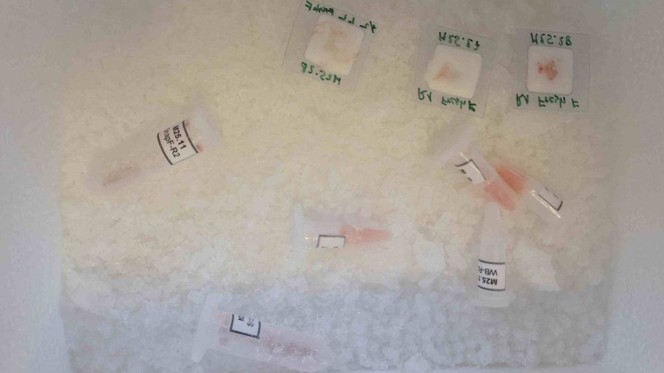 Zmražené jaterní vzorky pro molekulární analýzu | foto: Andrea Skalická, Český rozhlas Zmražené jaterní vzorky pro molekulární analýzu