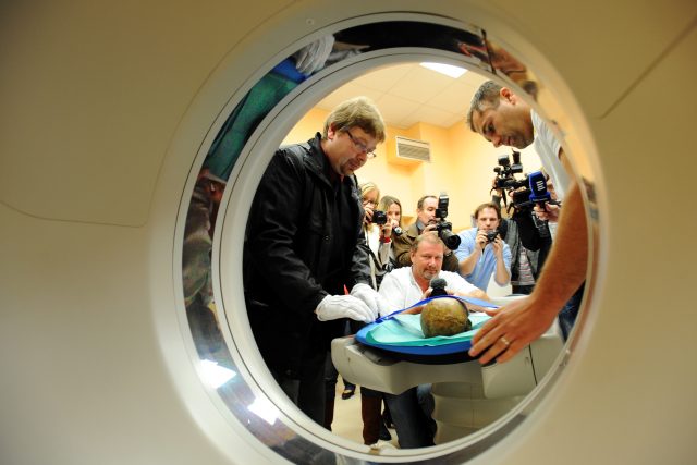 Táborská nemocnice vytvořila pomocí počítačové tomografie 3D snímek údajné lebky Jana Žižky z Trocnova | foto: ČTK