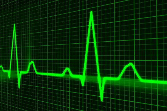 Zpožděná aktivace jedné srdeční komory může vést až k selhání srdce. Nová technologie měření EKG umí takové zpoždění velmi přesně změřit a lépe tak vybrat účinnou léčbu. | foto: CC0 Public domain