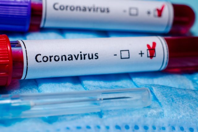 Koronavirus,  vzorek,  test,  laboratoř,  odběr krve,  Covid-19,  nákaza,  ilustrační | foto: Fotobanka Profimedia