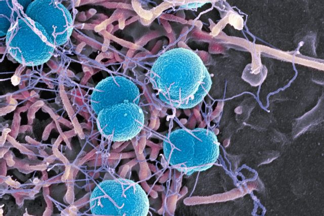 Obarvené bakterie meningokoka snímané elektronovým mikroskopem | foto: Profimedia