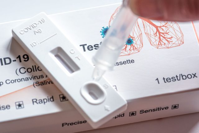 Ústav zdravotnických informací a statistiky sleduje pokles viru v populaci,  i když běžných testů ubývá. | foto: Shutterstock