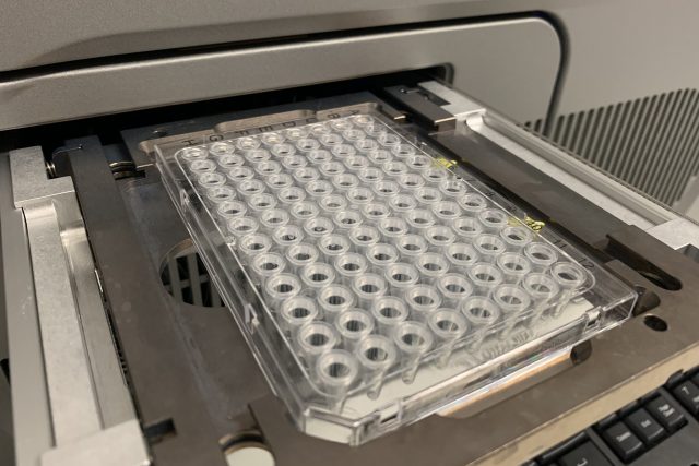 Čeští vědci testují PCR testy na covid-19 ze slin | foto: Matěj Skalický,  Český rozhlas,  Český rozhlas