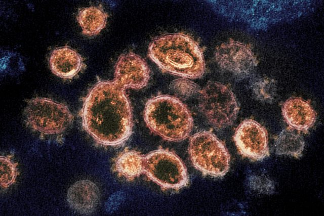 Nový koronavirus: snímek viru SARS-CoV-2,  který způsobuje nemoc COVID-19,  pod elektronovým mikroskopem. Výběžky na vnějším okraji vytvářejí podobu koróny či koruny,  dle čehož se koronaviry označují. Fotografie od amerického úřadu National Institute of Hea | foto: NIAID-RML/National Institute of Health,  Flickr,  CC0 1.0