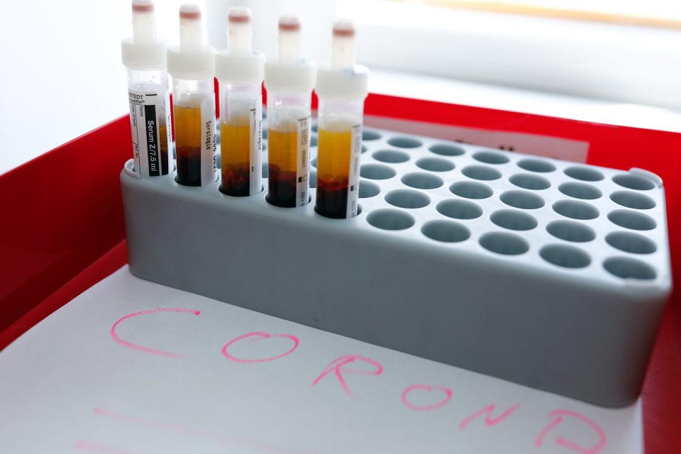 Vzorky připravené na testování v laboratoři na přítomnost koronaviru | foto: Axel Schmidt,  Reuters