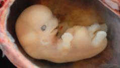 embryo v šestém týdnu těhotenství